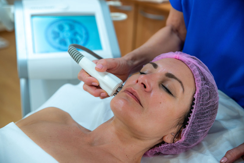 Rostro de mujer recibiendo tratamiento de mesoterapia facial en Clínica Isabel Aragón