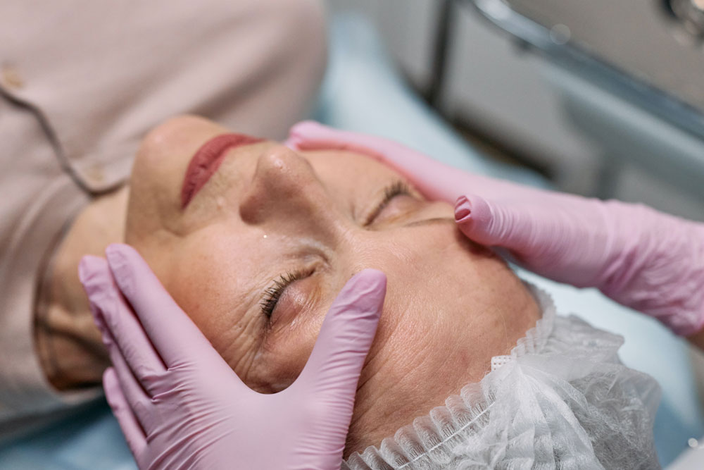Peeling rostro de mujer recibiendo sesión de peeling químico en Clínica Médico Estética Isabel Aragón