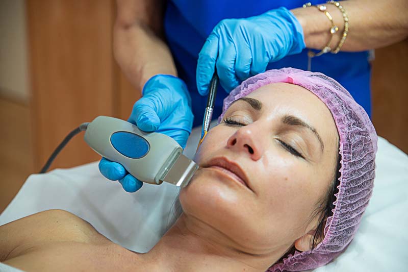 rostro de mujer recibiendo tratamiento de untrasonido en Clínica Médico Estética Isabel Aragón