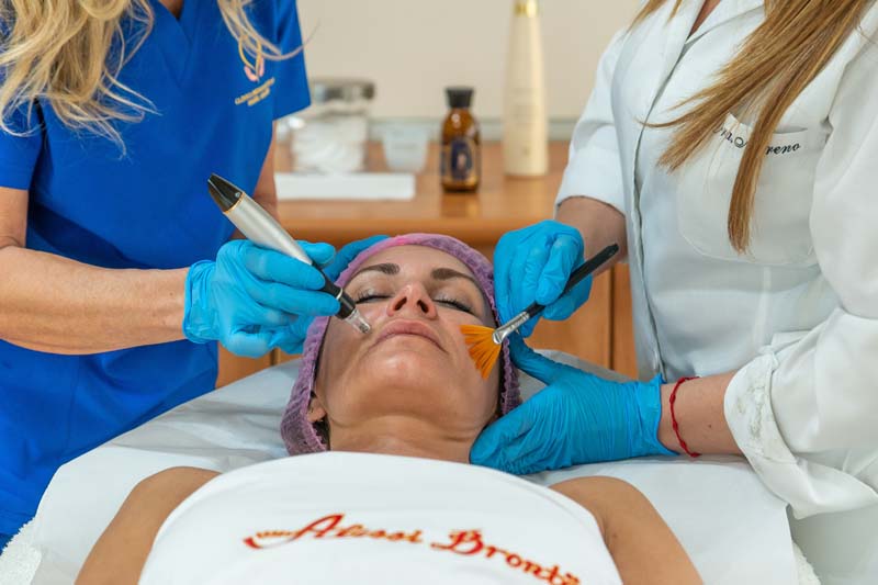 Biorevitalización_1 rostro de mujer recibiendo tratamiento de biorevitalización en Clínica Médico Estética Isabel Aragón