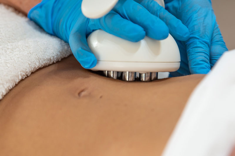 tratamiento liporeductor sobre abdomen en la Clínica Médico Estética Isabel Aragón
