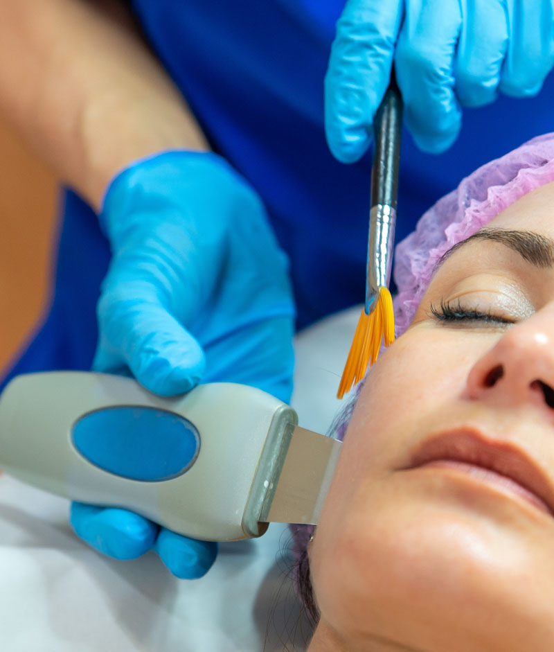 Rostro de mujer recibiendo tratamiento médico estética facial en Clínica Médico Estética Isabel Aragón