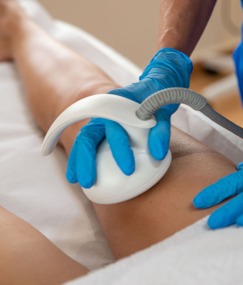 Rostro de mujer recibiendo tratamiento médico estética facial en Clínica Médico Estética Isabel Aragón