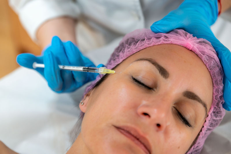 mesoterapia facial_ Rostro de mujer recibiendo sesión de mesoterapia facial en Clínica Médico Estética Isabel Aragón